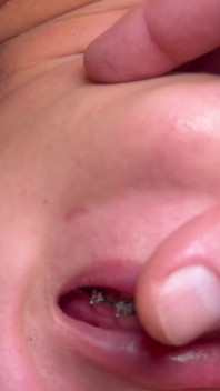 Brace Faced Teen Amira Mae Rough Throat Fucking & Ass Eating