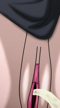 Tatsumaki Pipì (un uomo a pugno)