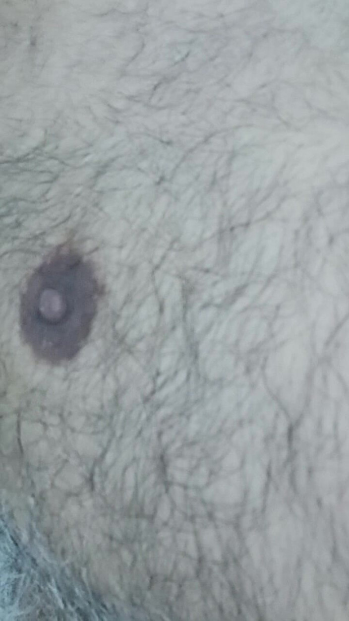 Daddy Dude: Indisk Pappa Som Ligger På Sängen Retar Och Poserar För...