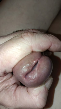 Is My Meatus Open?
