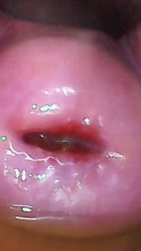 Kamera memek ekstrem close-up