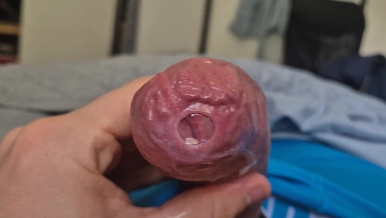GloomyChase977: Phimosis péro precum kapání zblízka
