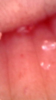 Medical Endoscope Oral Exam: Gummy Chewing, Extreme Teeth & Tongue Macro