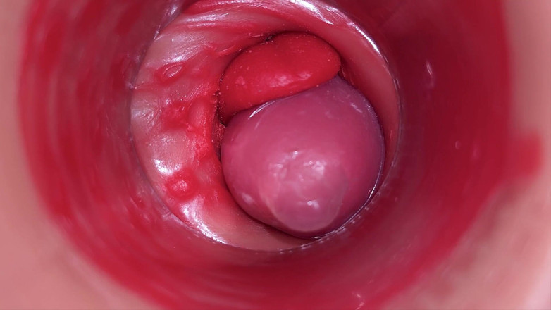 Ladybottox: Inside a Camgirl Cervix POV Camera in Vagina with Big...