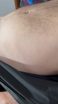 Dr Fer Is Dominated by a Patient-tied, Edge