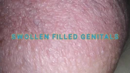 Swollen obscene filled silicone filled meat