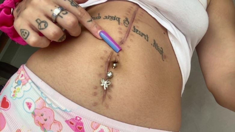 Nali Marie: Scar Fetish Belly Button Waist Tummy Skinny Teen Petite Flat...