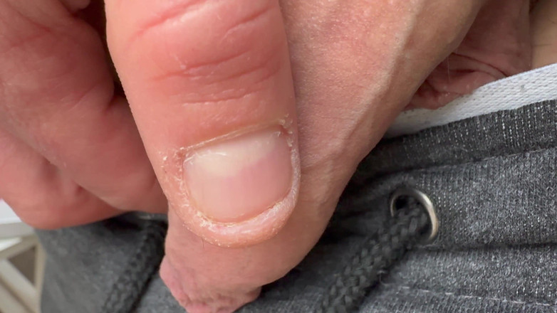 Nalekhome: 看看内裤下有什么