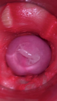 Camera Inside Pussy: Powerfull Cum in Pussy! Best Internal Asmr in 4K More Sperm