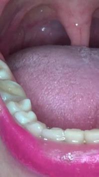 โชว์พลังสุดยอดให้เธอ!!!! Super Uvula