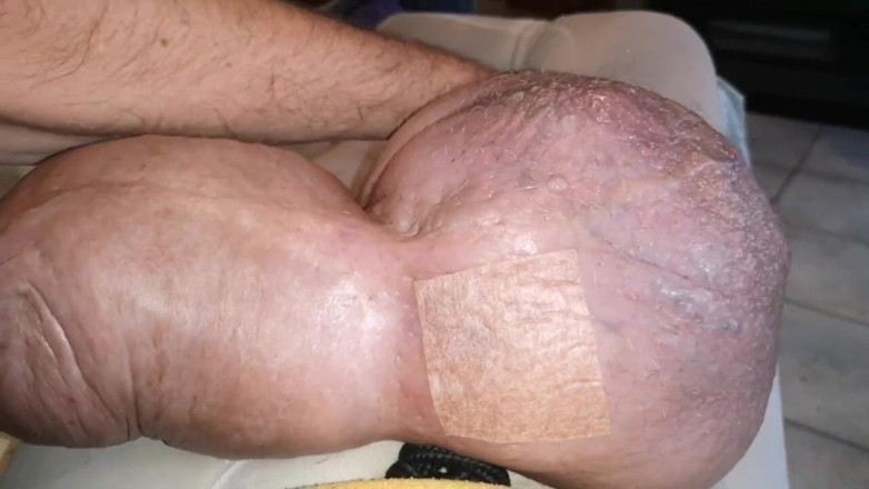 Monster_Meat_: Swollen obscene filled silicone filled meat