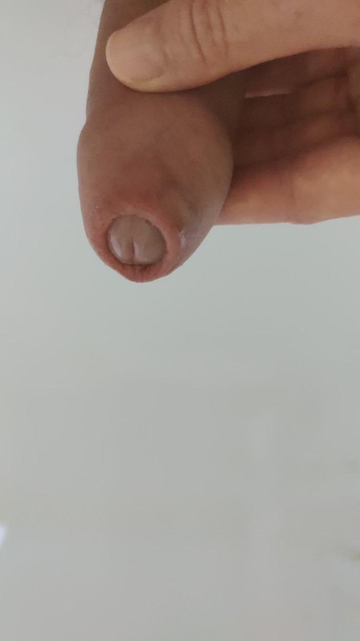 Peanuts_69: Uvolněné chcaní