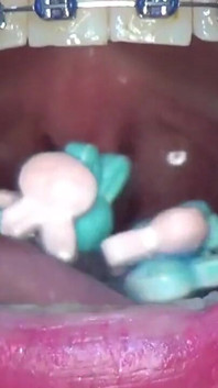 Playing and Swallowing a Candy-filled Condom in the Shape of a Rabbit