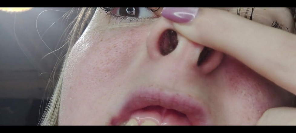 RavenHearth666VIP: 콧물 코 클로즈업