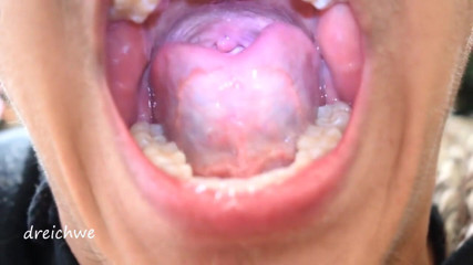 Dreichwe: Uvula fetish mouth