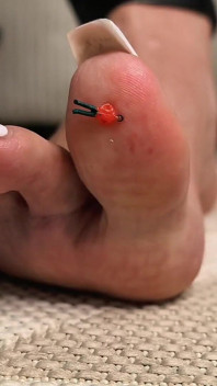 Poor Boy Under My Big Toe