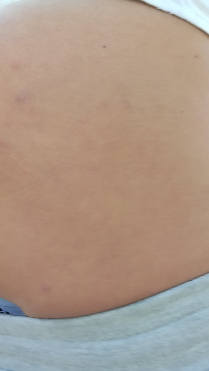 Morbosete000: 户外丁字裤