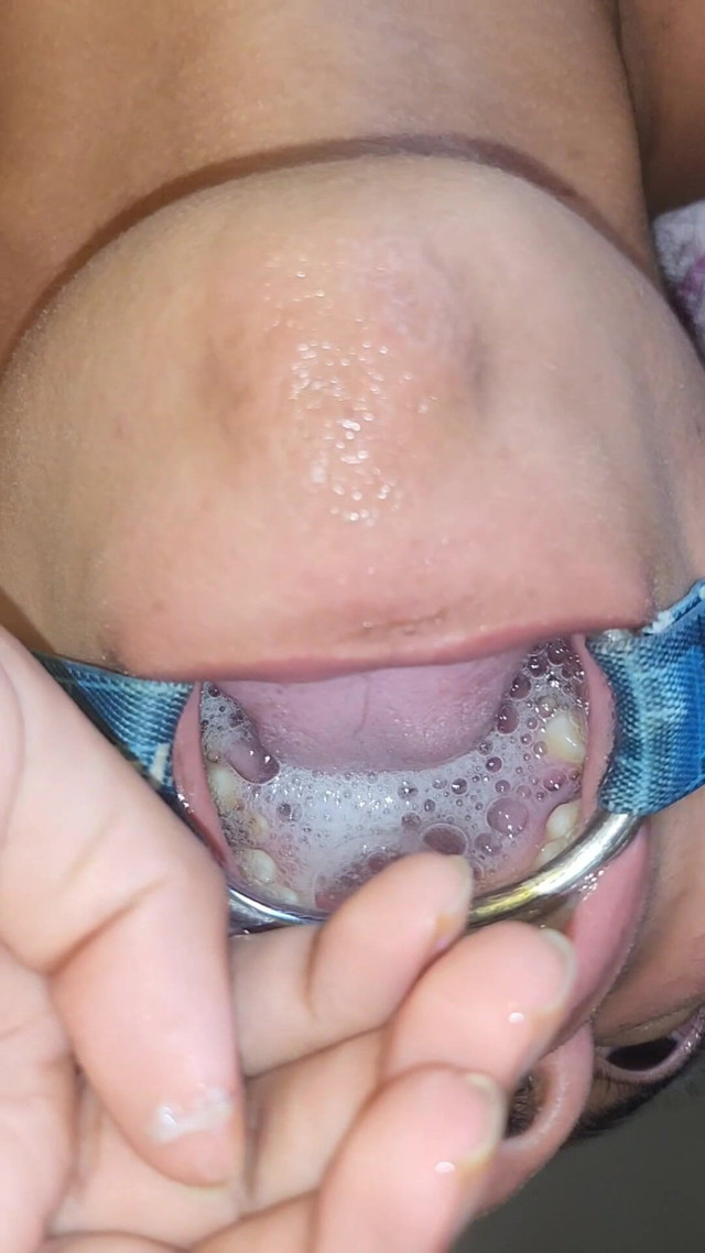 Throat Fuck with Open Mouth Gag and Spit Cum in Mouth (My throat is a cunt)