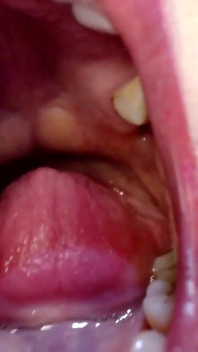Grand grand grand à l’intérieur de la bouche des deux filles