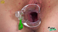 Gyno Exclusive: Speculum Exam of Hot Nerdy Teen Keira Flow