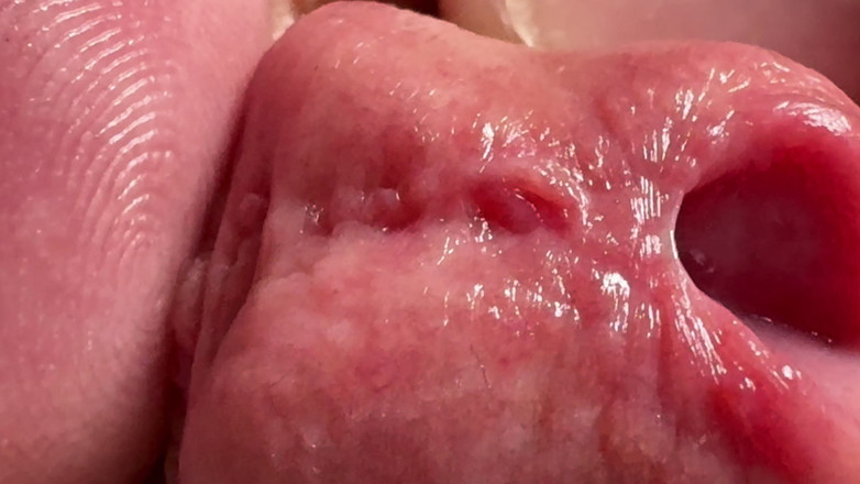 Leonardo-1974: Jari di Penis. Lubang di Penis Penetration.