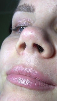 Nose Anna yang seksi