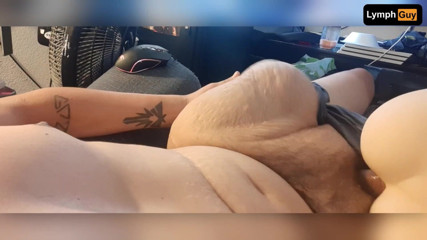 Lymph Guy: Il ragazzo con disabilità spara carico sullo stomaco