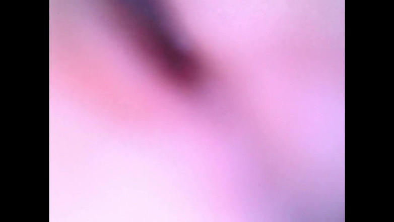 Idmir Sugary: Endoscope Details - Hole Balls Cock Foreskin Belly Nipples Mouth Sperm