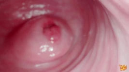 Hey stiefbrud! Lass uns spielen frauenarzt? Gynäkologie, Endoskopischeie - Mollyredwolf