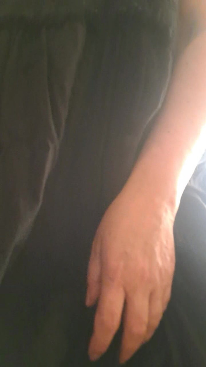 Mommy big hairy pussy: Kéo váy lên khoe lồn đầy lông