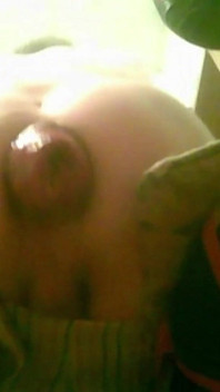 A Young Guy Is Sitting on a Chair with Anal Prolapse