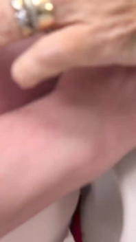 좀비 레즈