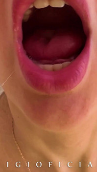 My Butthole Has Never Been Filmed so up Close! Even the Camera Has Broken