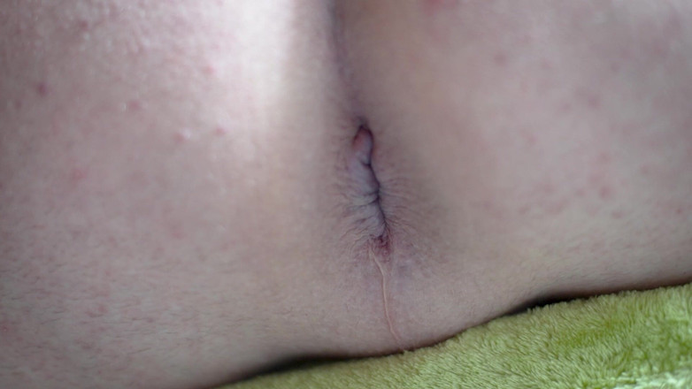 Marcus Pollack Gay: 멍청이 클로즈업