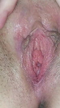 거대한 병으로 망치질!