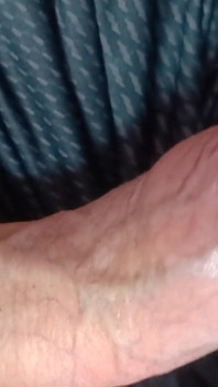 Tight Foreskin Large Cock Play- Playing with My Uncut Foreskin Phimosis Cock
