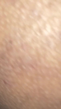 Medico üniversiteli kız ve profesör viral video