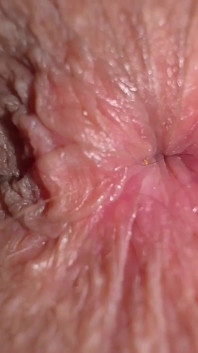 Extreme Anal View: My Stepdad Said a Few Words Into My Asshole,heard Me Fart Quietly and Realised He Had Rushed Anal