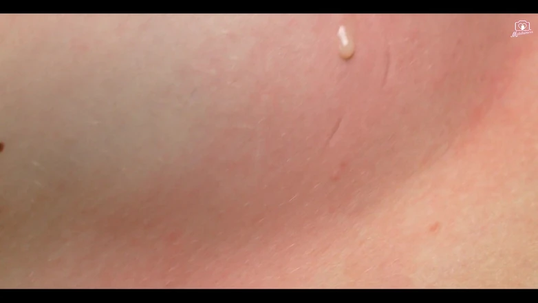 Medi Voi: Хочешь вкуса?