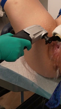 Gynecology Examiation - Squirting at the Amara Clinic