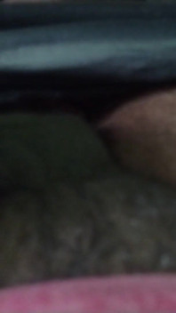 My Penis with Mole