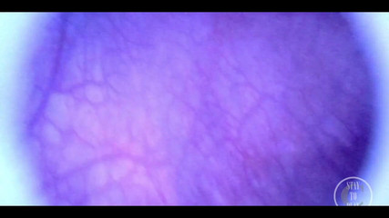 Lina Free: 내시경으로 내 방광의 아름다운 POV 내부!