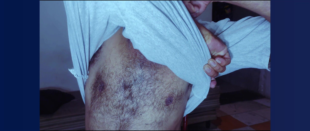 Stink HairyMale: Bụng, nách và tinh ranh