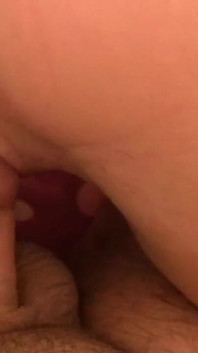 애널 스트레칭 후 헐렁한 젖은 튀어나온 로즈버드 Prolapse