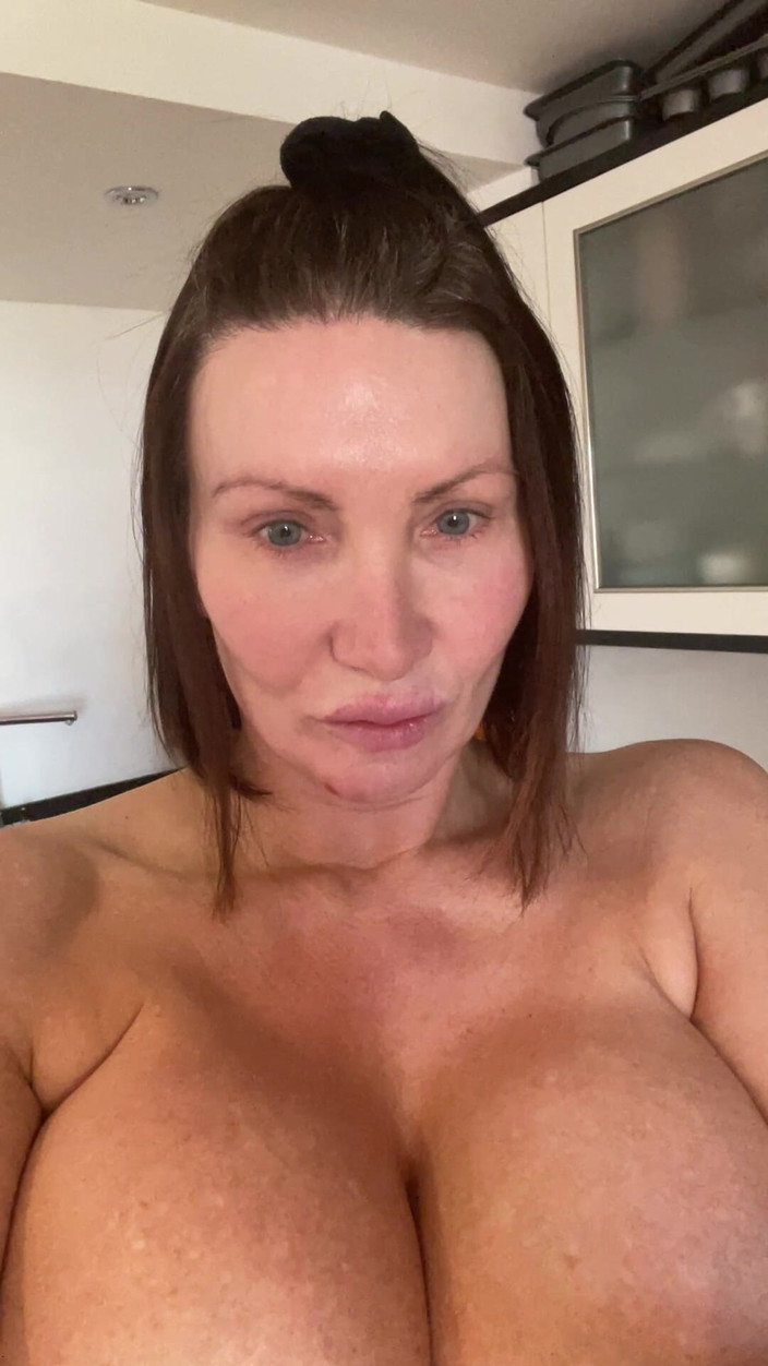 Sophie James: インプラント除去後の1stビデオ