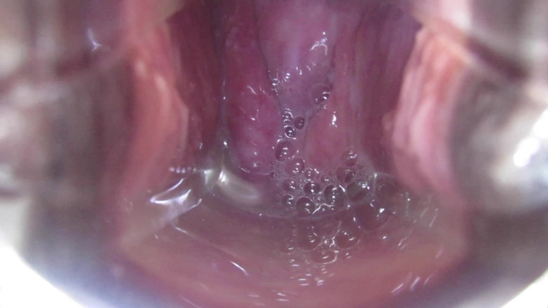 VeeVee Vixen: Sperma livmoderhals insemination