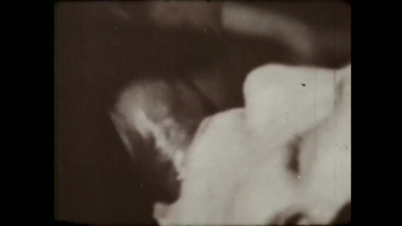 Vintage Usa: La Moglie Linfomane