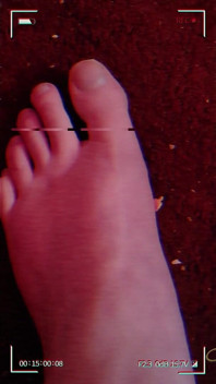 Une Géante Aux Pieds Nus Inhibée De Première Année