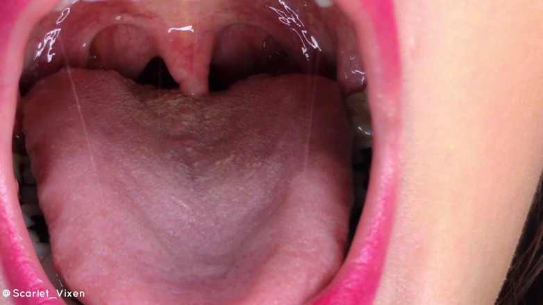 Scarlet Vixen: Uvula flexionando e vibrando