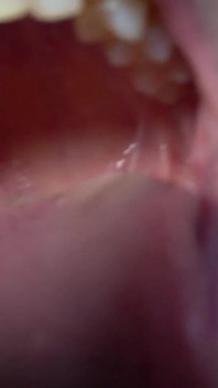 Tiny Little Dentist Tastes Like Bacon Gobbled up by Giantess Lucy